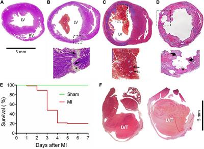 Pathogenetic Link of Cardiac Rupture and Left Ventricular Thrombus Following Acute Myocardial Infarction: A Joint Preclinical and Clinical Study